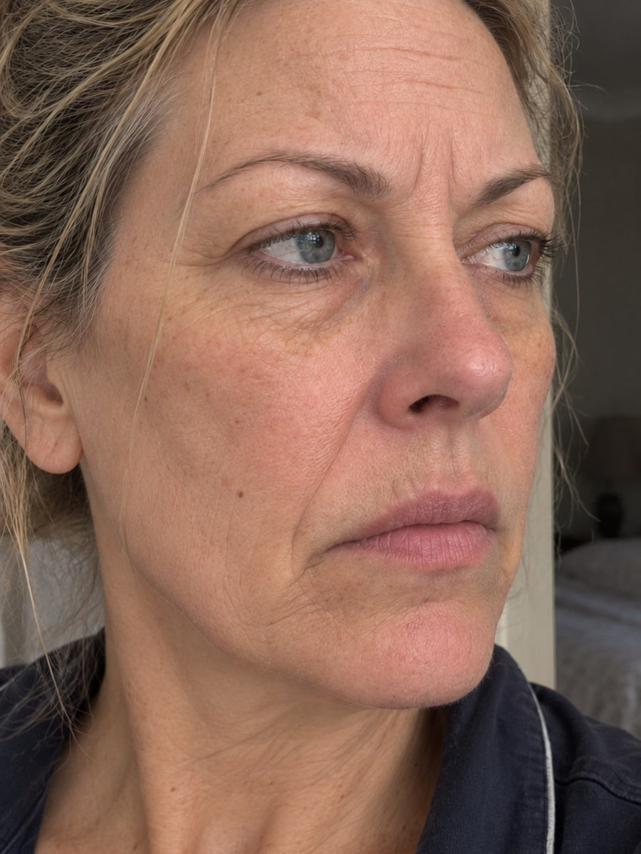 Close-up of a woman in her fifties with dull, tired-looking skin