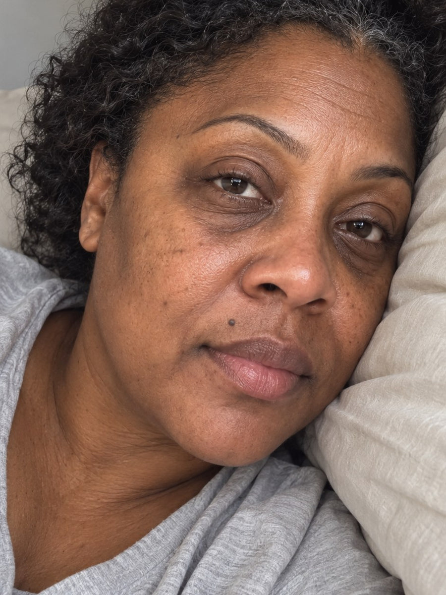 Woman resting her head on a pillow, skin looking tired and uneven